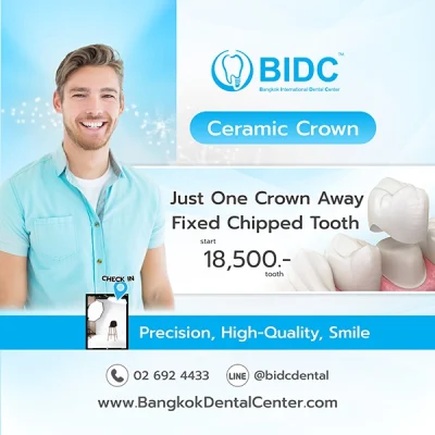 Promotion Dental Ceramic Crowns
