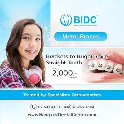Promotion Dental Metal Braces