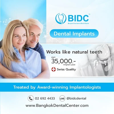 Promotion Dental Implant