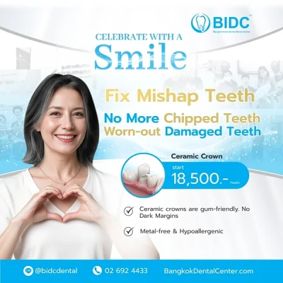 Promotion Dental Ceramic Crowns