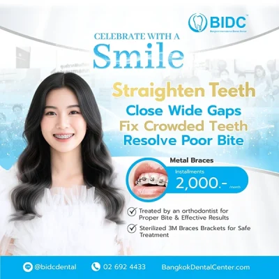 Promotion Dental Metal Braces